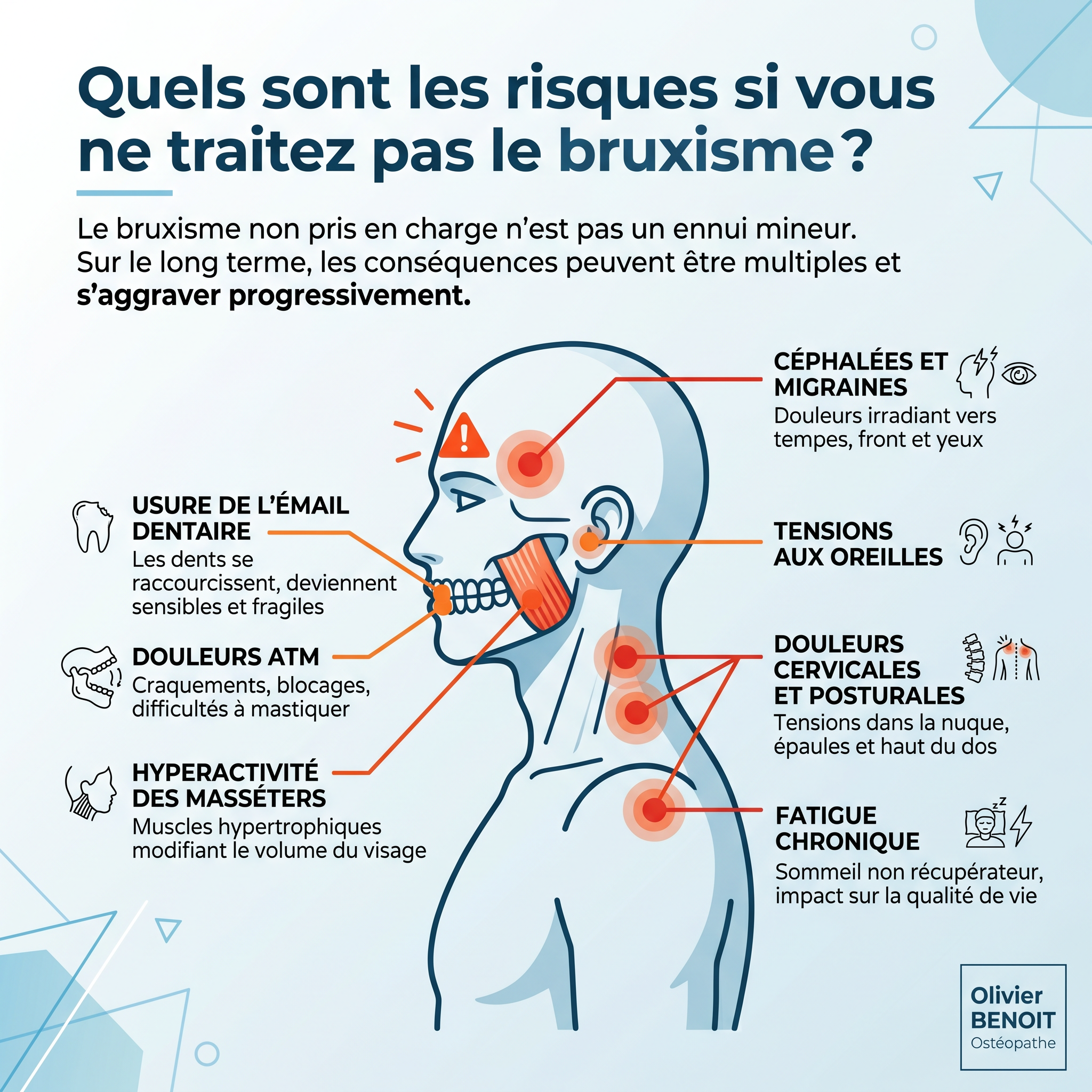 Infographie des zones de douleur liées au bruxisme nocturne (mâchoire, tempes, oreilles, cervicales) soulagées par l'ostéopathie à Bischwiller.
